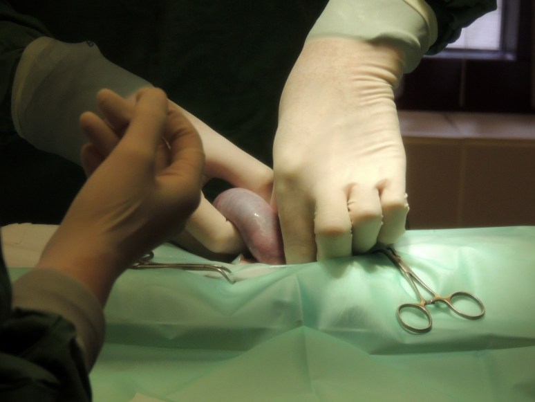 Bevalling 2015-07-15, 31