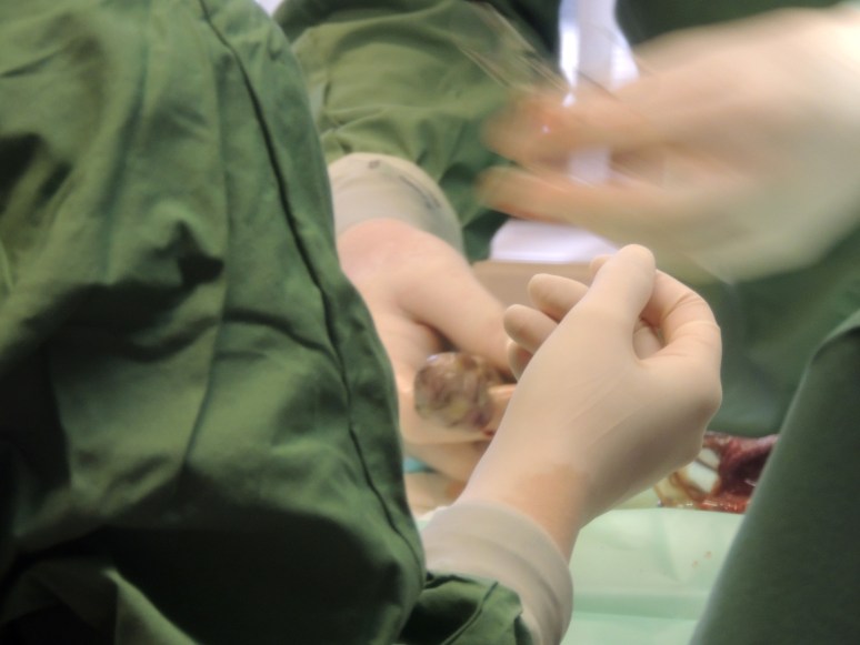 Bevalling 2015-07-15, 34