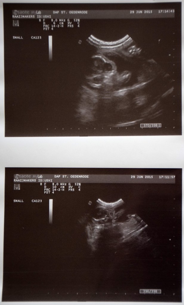 Echo Ushi's kitten 2015-06-29, 01