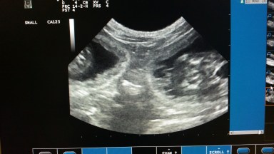 Echo Ushi 2016-03-16, 02_Samsung S5