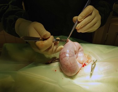 WK01_2016-04-05_006_bevalling